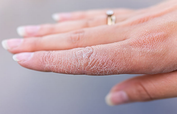 Kem trẻ hoá da tay xoá nhăn, giảm khô ráp