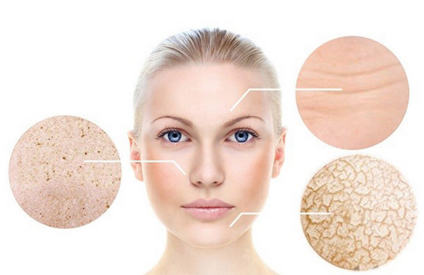 Mất collagen: Dấu hiệu nhận biết và tác hại với da