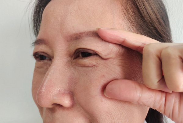 Mất collagen: Dấu hiệu nhận biết và tác hại với da