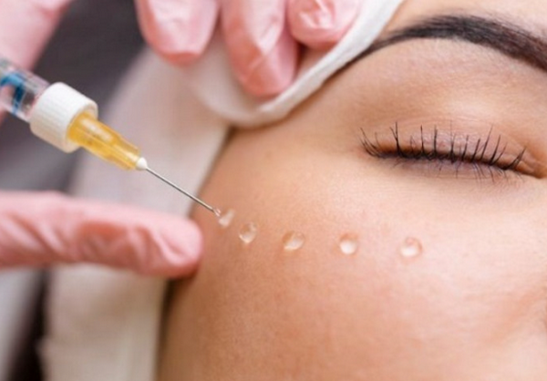 Hỏi đáp: Meso có mấy loại? Loại nào tốt nhất?