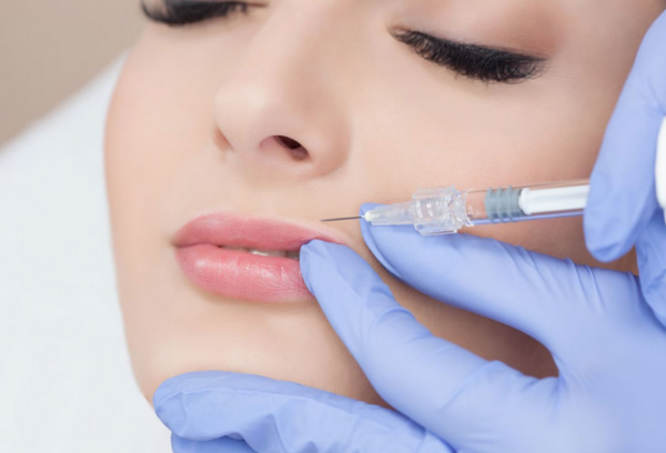 Nếp nhăn nhân trung: Nguyên nhân, ảnh hưởng và cách xoá nhăn