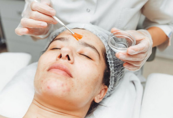 Phân biệt peel da và tẩy tế bào chết