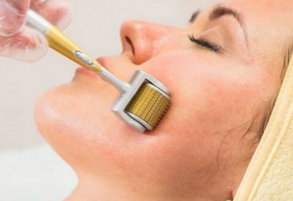 Sẹo đáy kim là gì? Đặc điểm nhận biết và cách điều trị hiệu quả