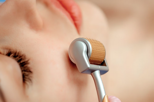 Sẹo nông: Đặc điểm nhận dạng và phương pháp làm đầy