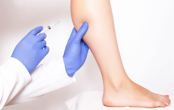 Tiêm botox bắp chân là gì? Có nên tiêm hay không?