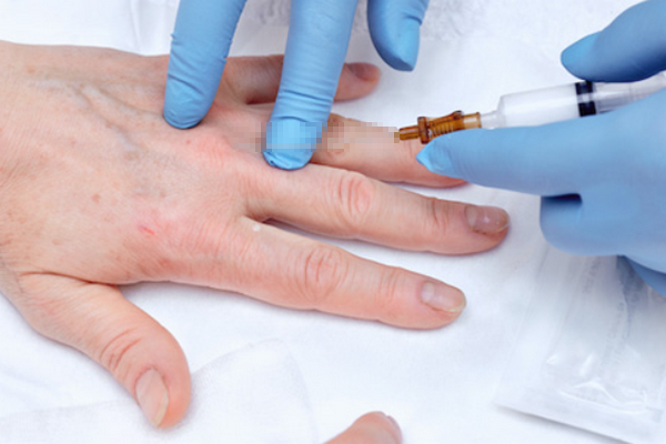 Tiêm trẻ hoá da tay: Cơ chế, chỉ định và những lưu ý an toàn