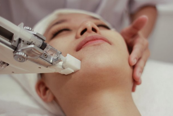 Cấy căng bóng da mặt có tốt không? Phù hợp với ai