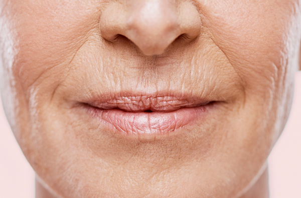 Nếp nhăn môi do đâu, cách khắc phục hiệu quả
