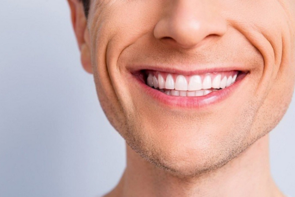 Nếp nhăn ở miệng khi cười: Nguyên nhân, ảnh hưởng và cách xoá nhăn