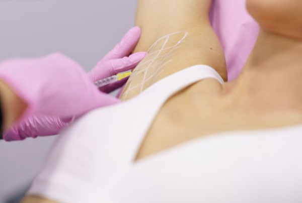 Tiêm hôi nách bao lâu một lần? Liệu trình, tần suất và lưu ý quan trọng