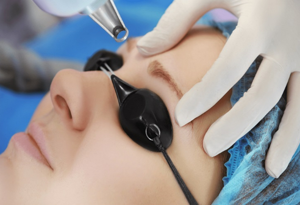 Xoá mực xăm trổ màu như thế nào? Công nghệ xoá xăm an toàn