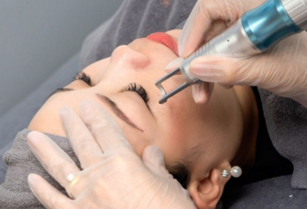 Xoá xăm mí mắt có đau không? Làm bao nhiêu lần hiệu quả