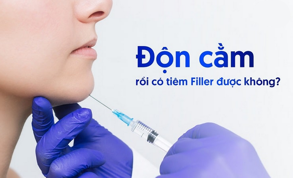Hỏi đáp: Độn cằm rồi có tiêm filler được không?