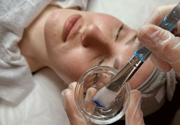 Peel da nhẹ có hiệu quả không? Phù hợp với ai