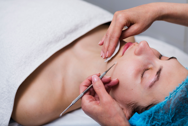 Peel da xong bị mụn có nguy hiểm không? Nguyên nhân là gì?