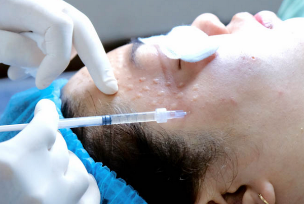 Tiêm meso có bị phụ thuộc không? Chuyên gia chia sẻ