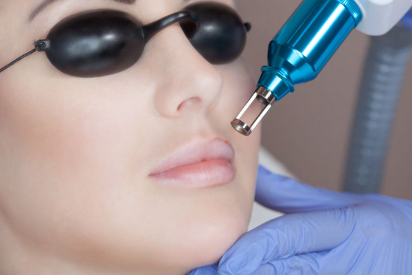 Xóa xăm môi bằng laser hiệu quả không? Cần lưu ý gì?
