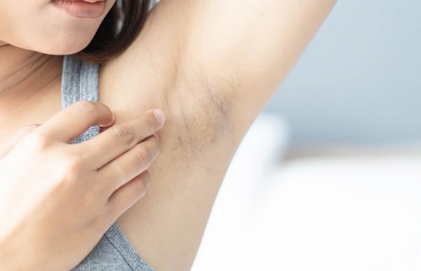 Bao nhiêu tuổi thì triệt lông được? Độ tuổi an toàn bạn nên biết