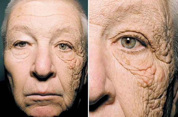 Kem chống nắng phổ rộng là gì? Có thật sự tốt?