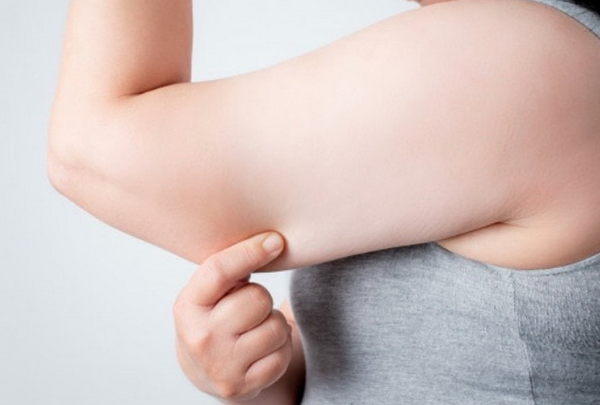 Rạn da bắp tay là gì? Nguyên nhân và cách cải thiện hiệu quả