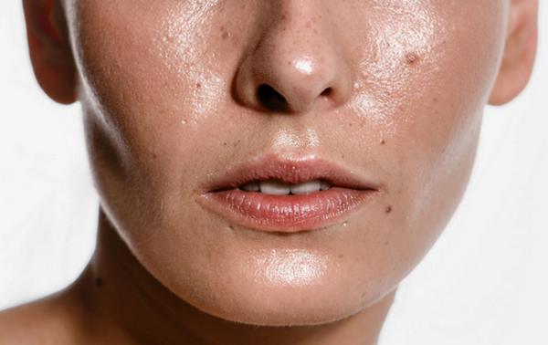 Thức khuya có gây mụn không? Nguyên nhân & cách cải thiện hiệu quả