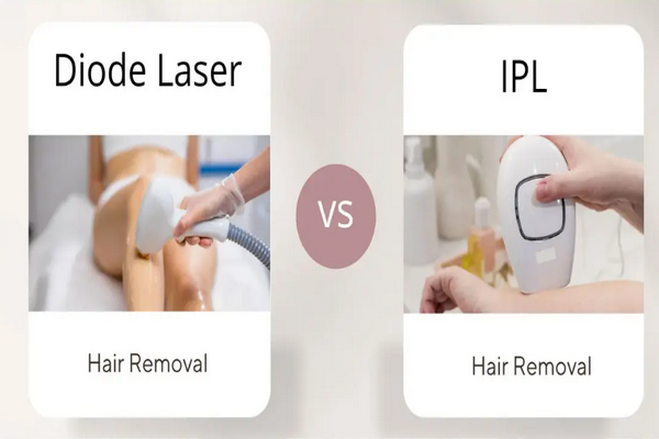 Triệt lông Diode laser và IPL cái nào tốt hơn? So sánh chi tiết từ A-Z