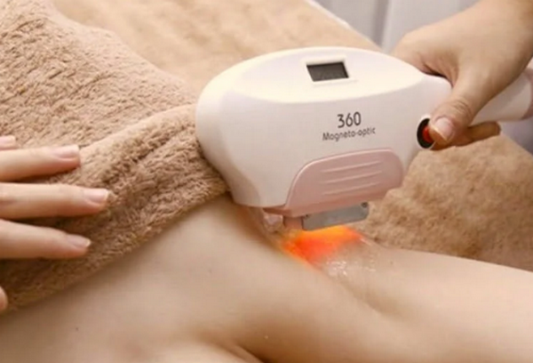 Triệt lông lạnh là gì? Công nghệ triệt lông hiện đại và an toàn