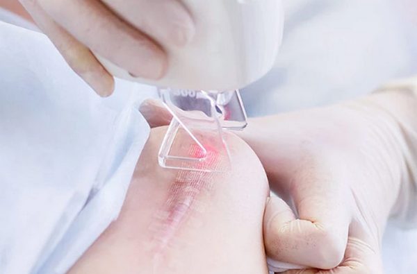 Vết mổ sau sinh bao lâu thì lành? Có để lại sẹo không