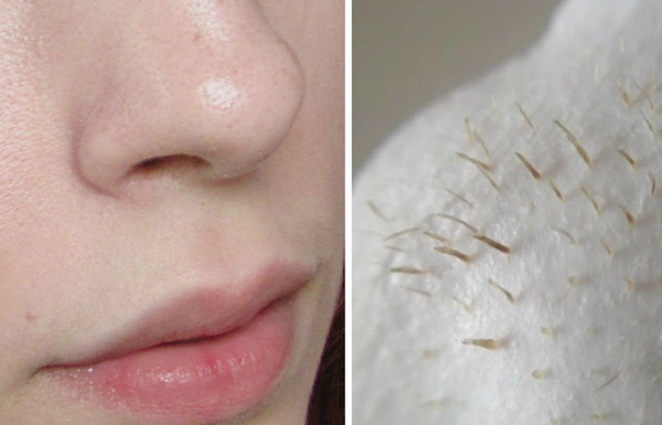 7 cách loại bỏ sợi bã nhờn ở mũi tại nhà: Đơn giản nhưng cực hiệu quả