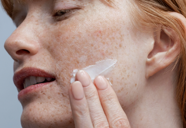 Nám da nên dùng hoạt chất gì? 7 hoạt chất trị nám được bác sĩ tin dùng