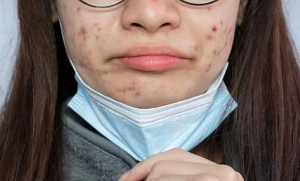 Khẩu Trang Chống Nắng: Cách Chọn, Sử Dụng Hiệu Quả & Sai Lầm Cần Tránh