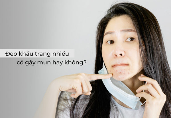 Mụn do đeo khẩu trang (Maskne): Nguyên nhân và cách xử lý hiệu quả