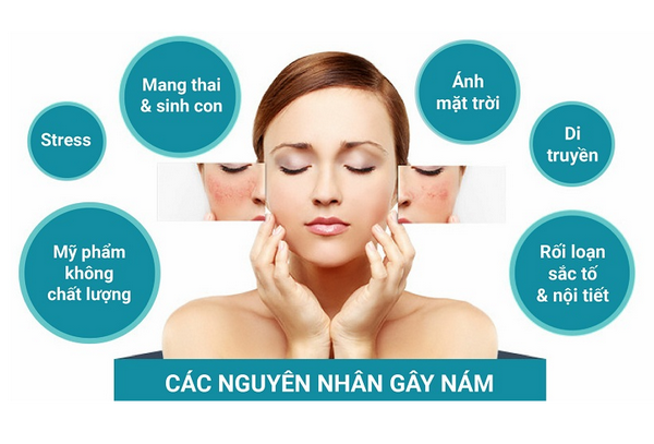 Nám Da Lâu Năm Có Tự Khỏi Không? Cách Điều Trị Hiệu Quả Nhất