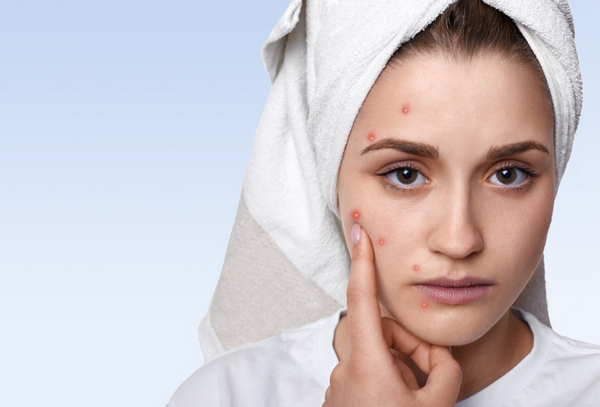 Nước ép trái cây có tốt cho da không? Uống sai dễ nổi mụn