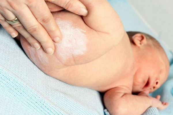 Phấn rôm là gì? Có an toàn không? Cách sử dụng phấn rôm