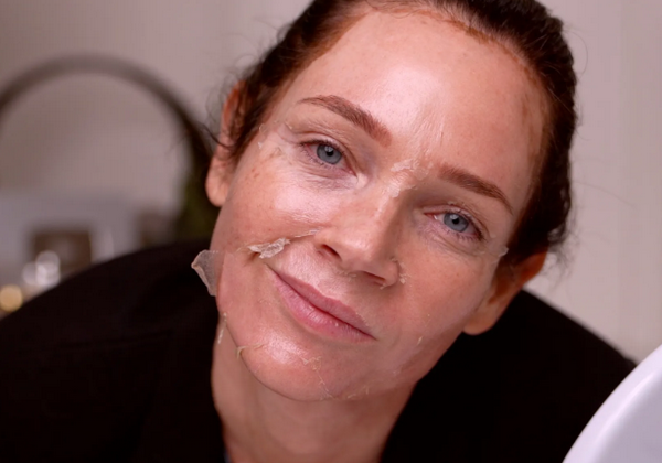 TCA peel là gì? Có tốt không? Những lưu ý an toàn