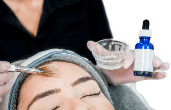 TCA peel là gì? Có tốt không? Những lưu ý an toàn