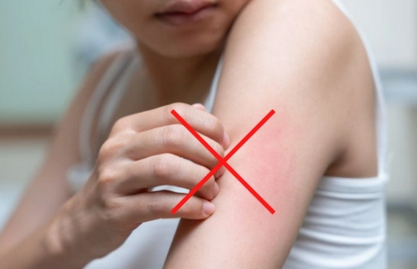 Triệt lông laser bị ngứa: bình thường hay bất thường?