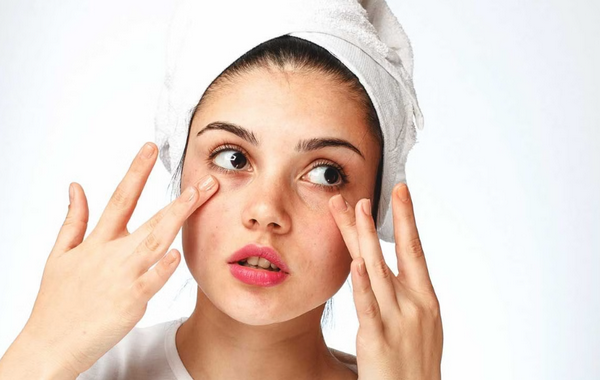 Vì sao mùa hè dễ nổi mụn hơn? Cách khắc phục hiệu quả