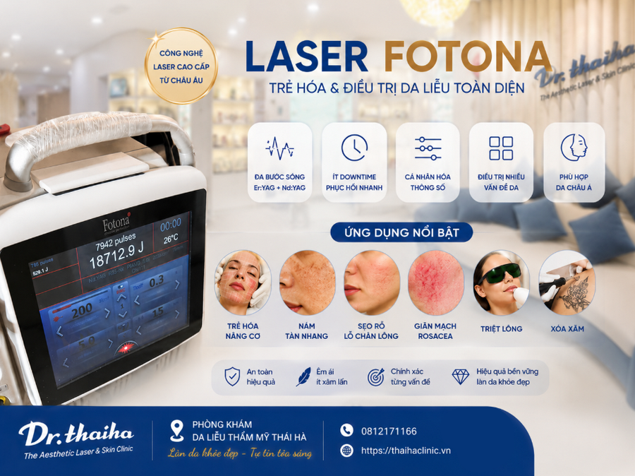 Laser Fotona 4D là gì? Công dụng và ứng dụng trẻ hóa da toàn diện