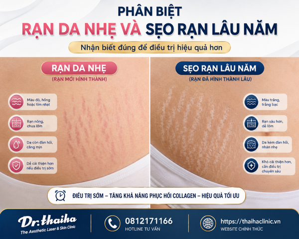 Phân biệt rạn da nhẹ và sẹo rạn lâu năm
