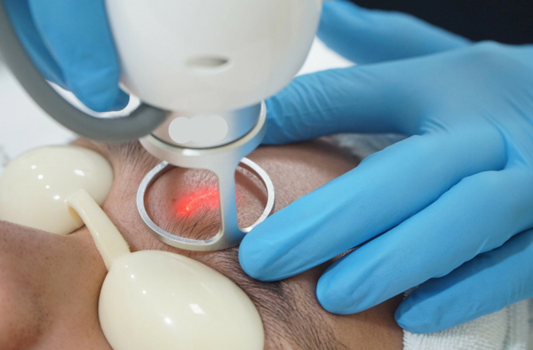 Sẹo quá phát là gì? Nguyên nhân & cách điều trị hiệu quả