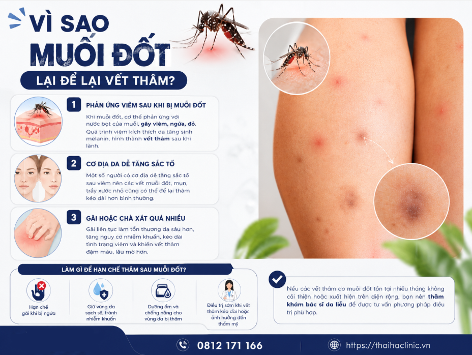 Sẹo thâm do muỗi đốt có tự hết không? Cách làm mờ nhanh tại nhà