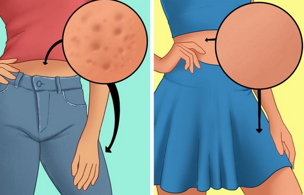 8 cách trị chai cứng mông tại nhà giúp da mềm mại hơn
