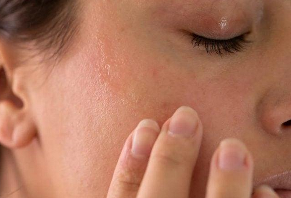 Vì sao da khô căng sau khi rửa mặt? 7 nguyên nhân thường gặp
