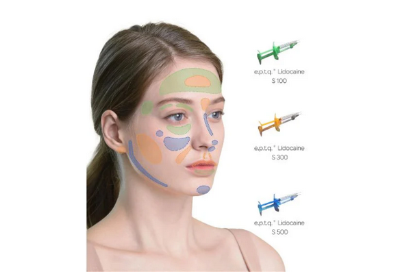 Filler E.P.T.Q: Công dụng, thành phần và so sánh với loại filler khác