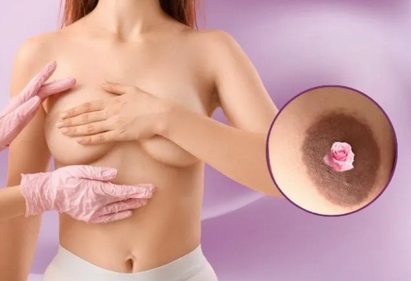 7 Sai Lầm Khi Dùng Kem Trị Thâm Nhũ Hoa Khiến Hiệu Quả Kém Đi