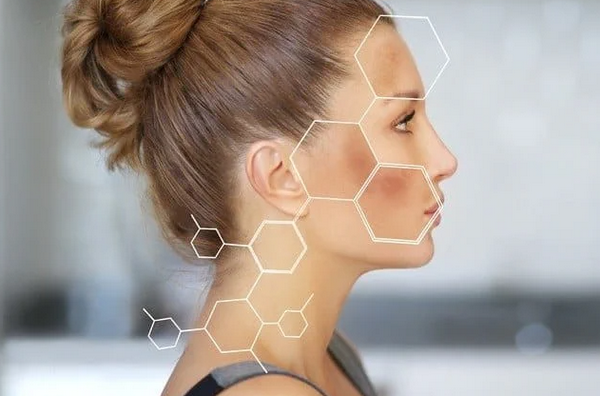 Nám Thượng Bì Là Gì? Dấu Hiệu, Nguyên Nhân Và Cách Điều Trị Hiệu Quả