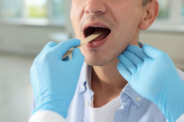 Bệnh Nấm Lưỡi: Nguyên Nhân, Dấu Hiệu Và Cách Điều Trị