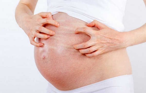 Ngứa Da Khi Mang Thai: Nguyên Nhân Và Cách Giảm An Toàn Cho Mẹ Bầu